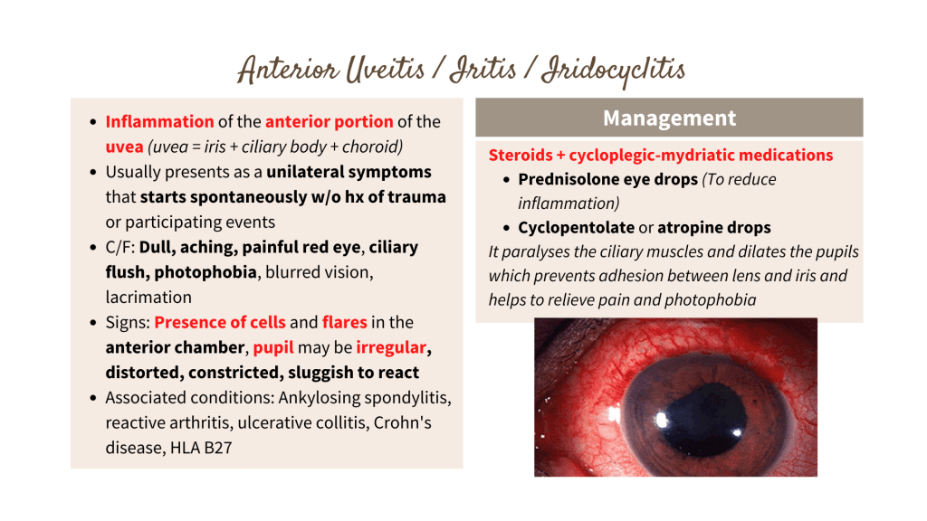 Anterior Uveitis, Iritis and Iridocyclitis