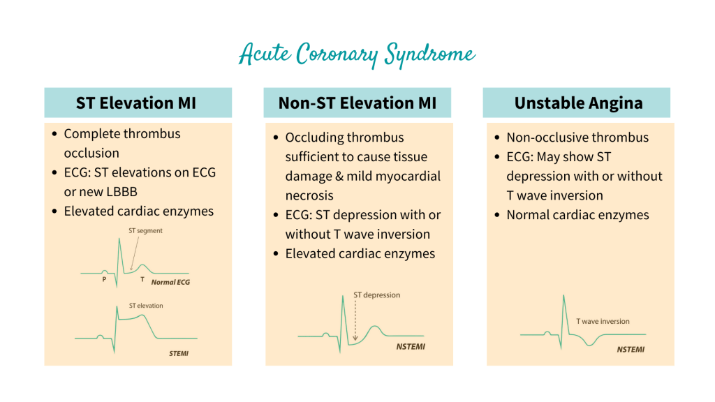 Acute Coronary Syndrome (ACS), ST Elevation Myocardial Infarction (STEMI), Non-ST Elevation MI (NSTEMI) and Unstable Angina