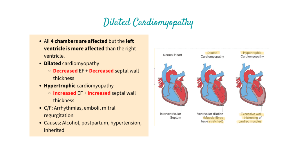 Dilated Cardiomyopathy. Hypertrophic Cardiomyopathy