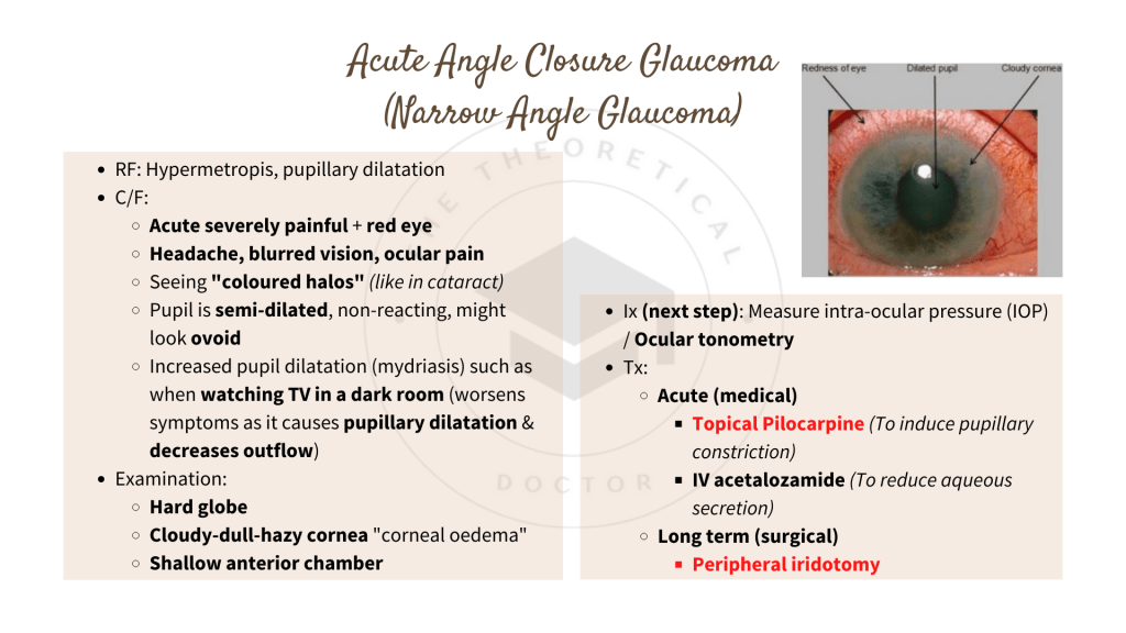 Acute Angle Closure Glaucoma (Narrow Angle Glaucoma)