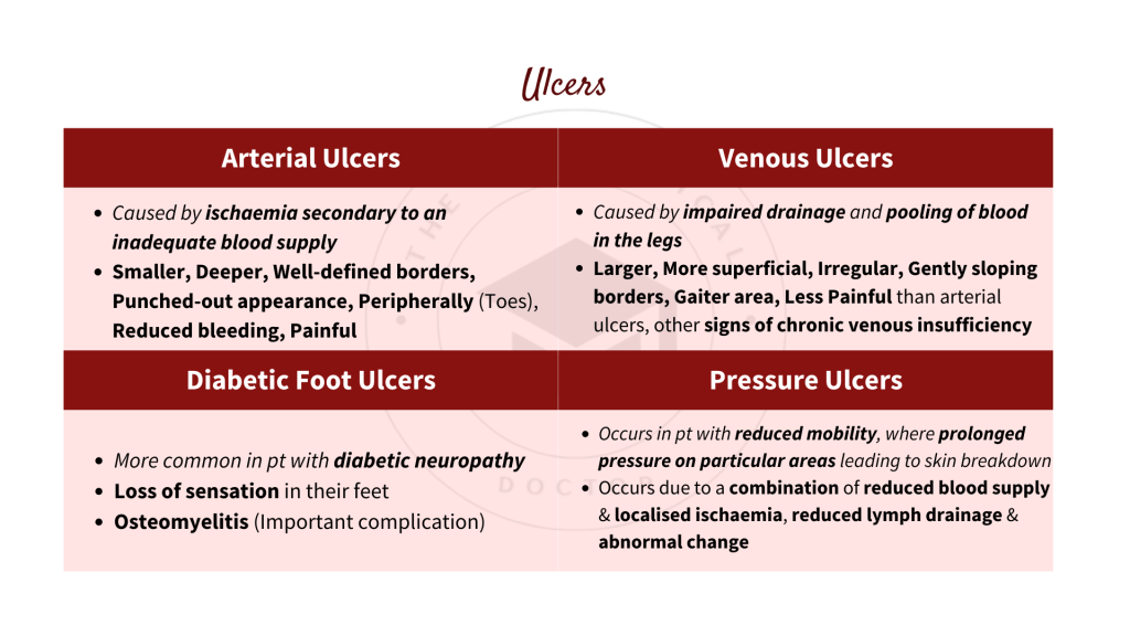 What are the types of foot ulcers? How to differentiate between arterial ulcers, venous ulcers, diabetic foot ulcers and pressure ulcers?