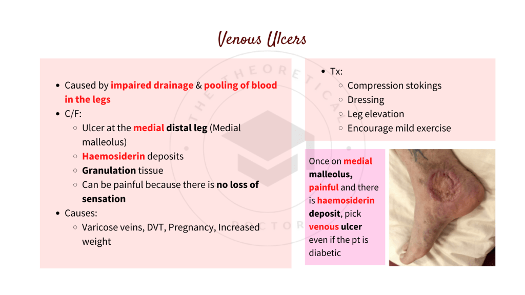 Presentation, signs and symptoms of venous ulcers in foot
