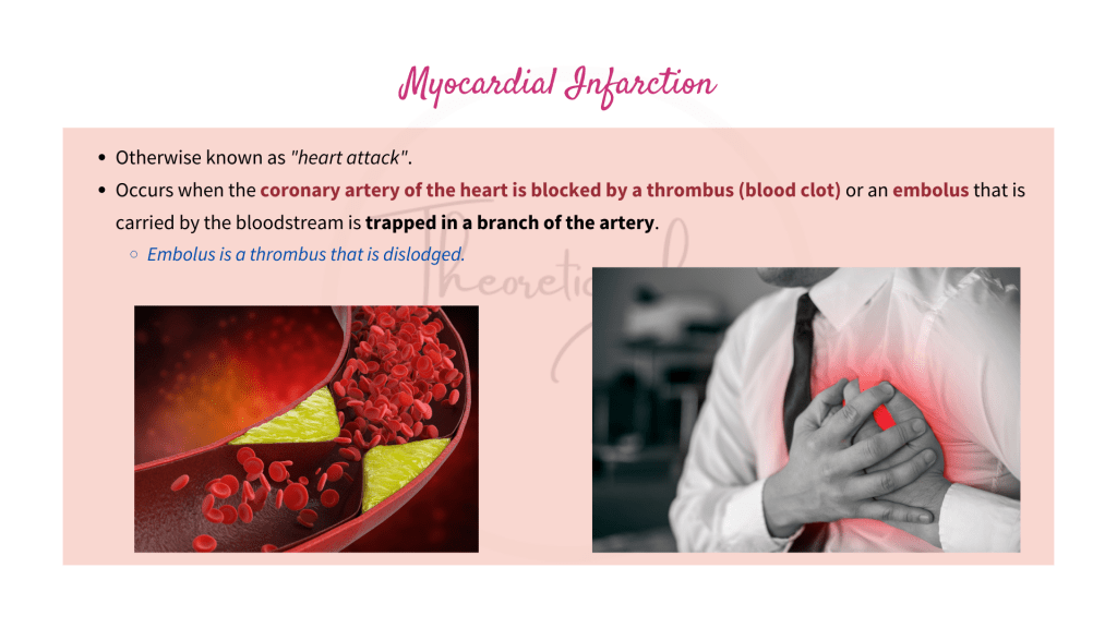 Explanation on myocardial infarction (heart attack).