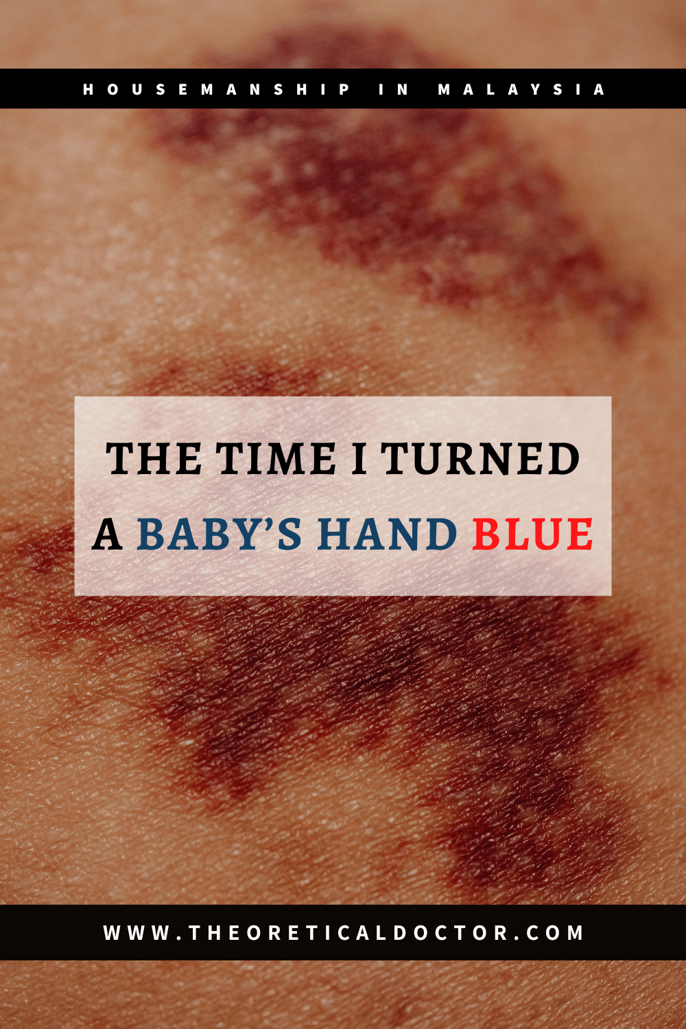 The Time I Turned A Baby’s Hand Blue – Housemanship&nbsp;Diaries